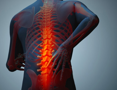 Ankylosing Spondylosis Understanding Symptoms Treatments And Differences With Ankylosing