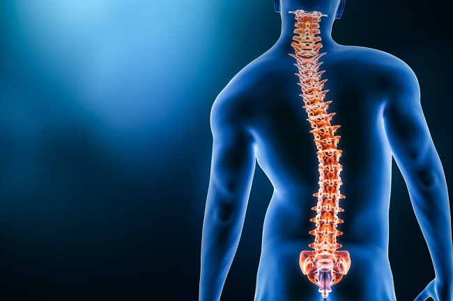 Scoliosis Deformity of Spine